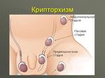 Европейские рекомендации по диагностике и лечению мужского бесплодия - Подготовил: Абдимажит А.М. Куратор: проф. Кусымжанов С.М.