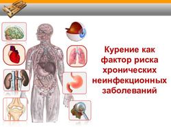 Курение как фактор риска хронических неинфекционных заболеваний - Центр медицинской профилактики