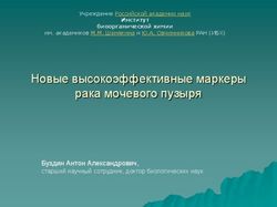 Новые высокоэффективные маркеры рака мочевого пузыря